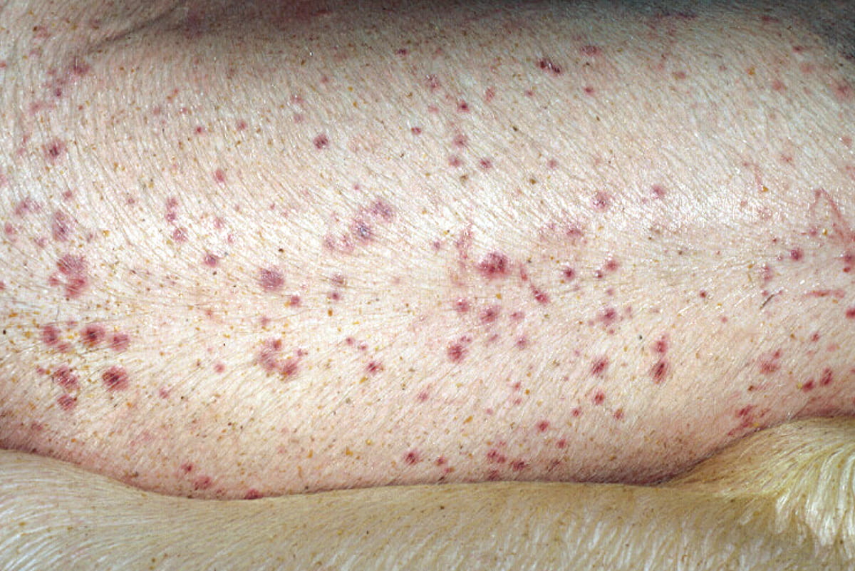 Control Mosquitoes to Prevent Costly Bite Marks on Hogs