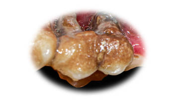 advanced periodontal disease on canine tooth