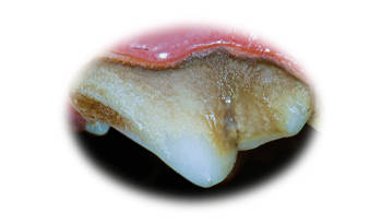gingivitis plaque on canine tooth
