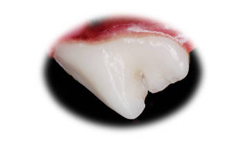 image of a healthy dog tooth