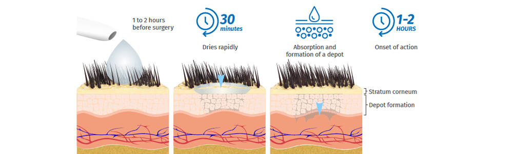 Zorbium™ Transdermal Solution application